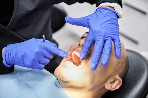 Best Emergency Root Canal Treatment in Larimore, ND
