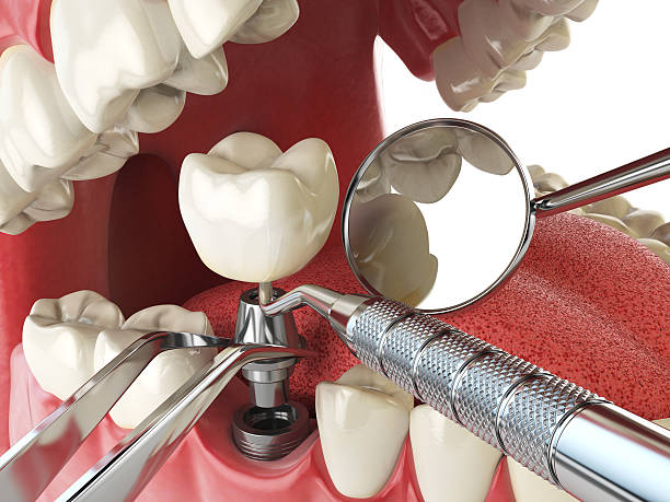 Best Emergency Denture Repair in Larimore, ND